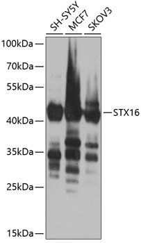 STX16 antibody
