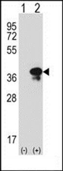 STX3 antibody
