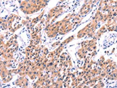 STXBP2 antibody