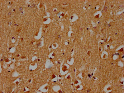 STXBP5 Antibody