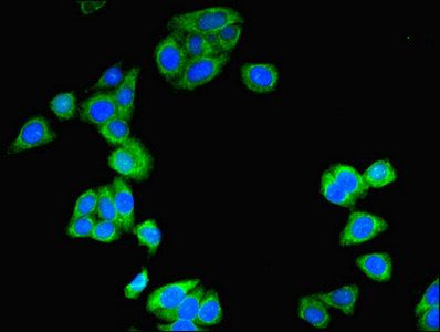 STXBP6 antibody