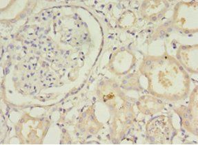 STXBP6 Antibody
