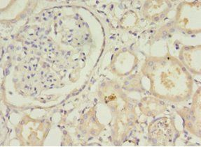 STXBP6 antibody