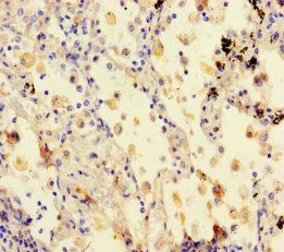 STXBP6 Antibody