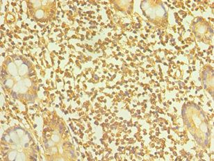 TAC1 Antibody