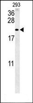 TAC1 antibody (C-term)