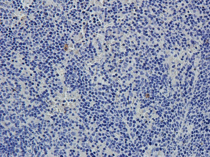 Substance P antibody