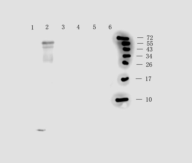 Substance P antibody