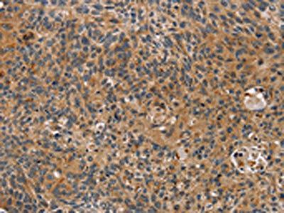 TAC1 Antibody