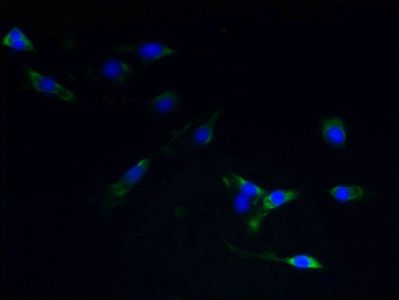 Substance P R antibody