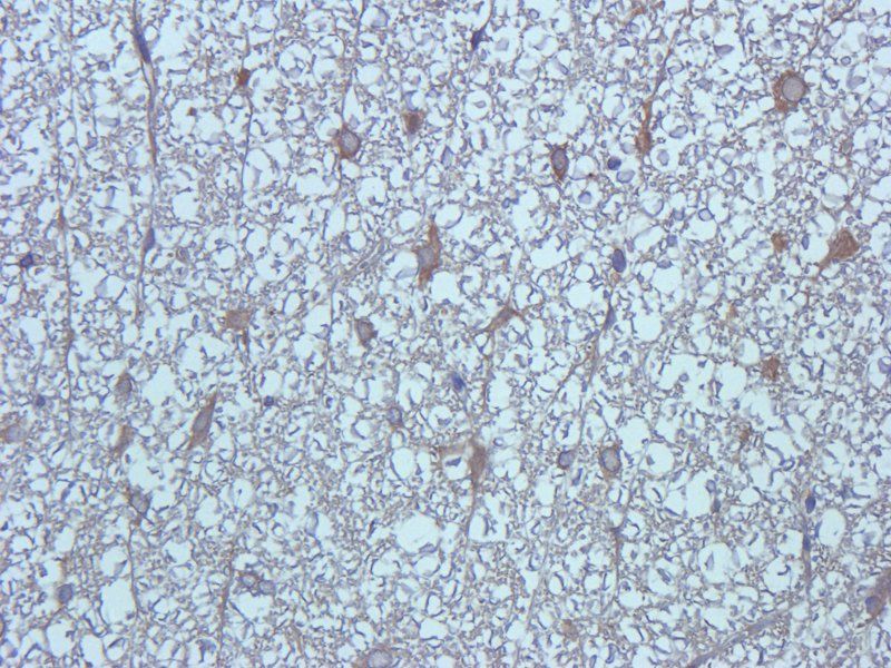 Substance P antibody