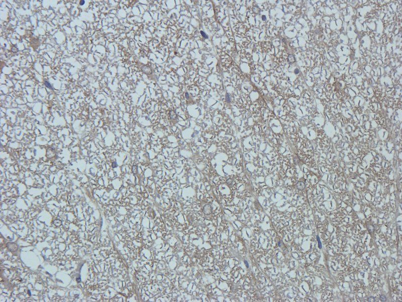 Substance P antibody