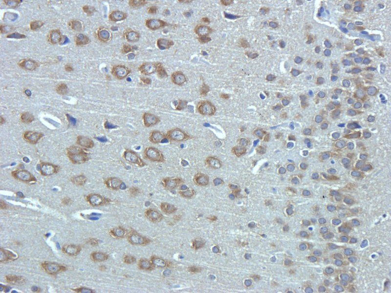 Substance P antibody