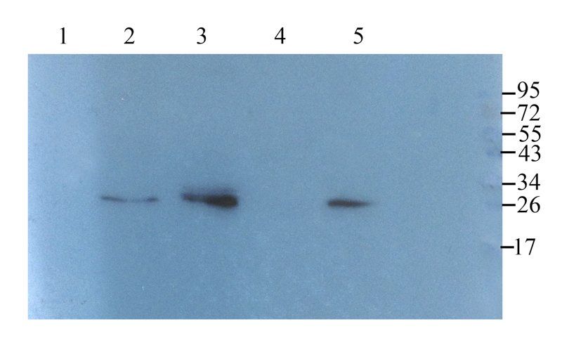 Substance P antibody