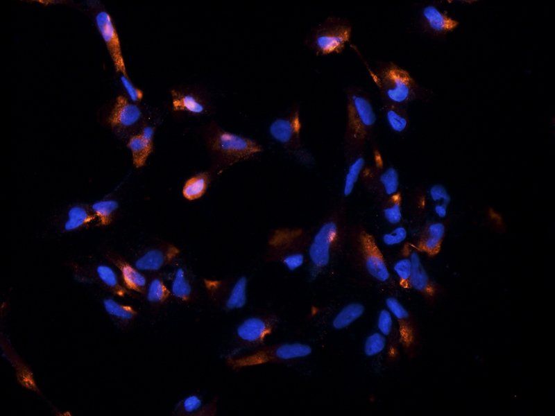 Substance P antibody