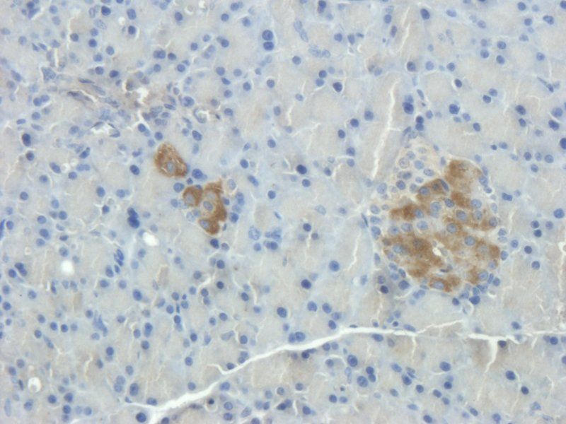 Substance P antibody