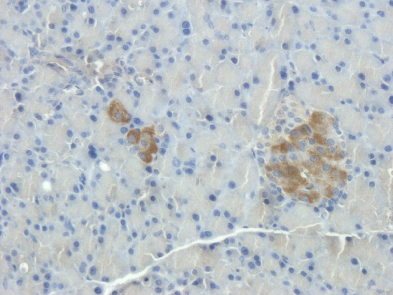 Substance P antibody