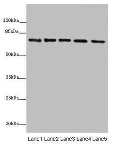 Succinate dehydrogenase [ubiquinone] flavoprotein subunit, mitochondrial antibody [Out of stock]