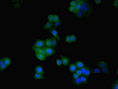 SDHA Antibody