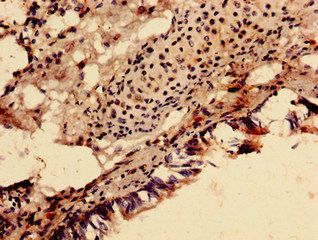 SDHA Antibody