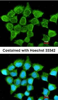 succinate-CoA ligase, ADP-forming, beta subunit precursor antibody