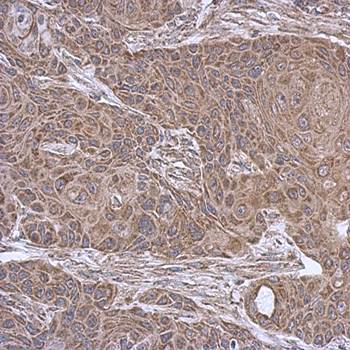 succinate-CoA ligase, ADP-forming, beta subunit precursor antibody