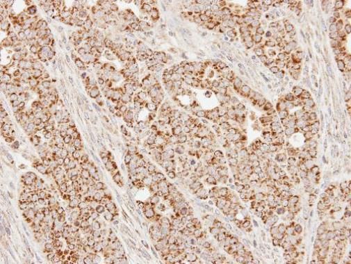 SUCLG1 antibody