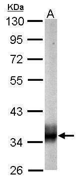 succinate-CoA ligase alpha subunit Antibody