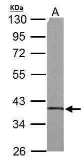 succinate-CoA ligase alpha subunit Antibody