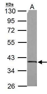 SUCLG1 antibody