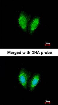 SUCLG1 antibody