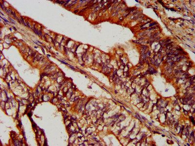 SUCLG2 Antibody