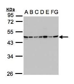 succinate-CoA ligase GDP-forming beta subunit Antibody