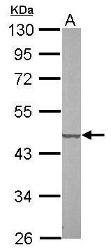 succinate-CoA ligase GDP-forming beta subunit Antibody