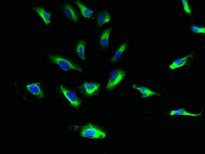 SUCNR1 antibody