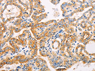 SUFU Antibody