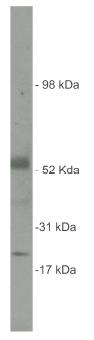Rabbit Human Sulf2 Antibody