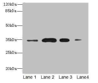 SULT1A3 Antibody
