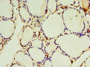 SULT1C2 Antibody