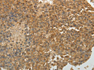 SULT1E1 Antibody