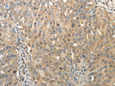 SULT1E1 Antibody