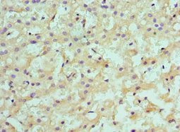 SULT2A1 Antibody