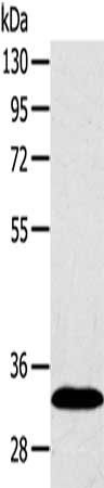 SULT2A1 antibody