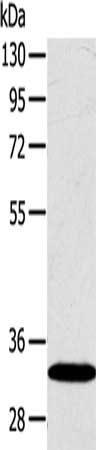 SULT2A1 Antibody