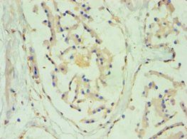 SULT2B1 Antibody