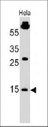 SUMO1 antibody
