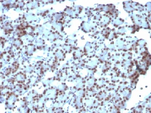 SUMO-1 Antibody