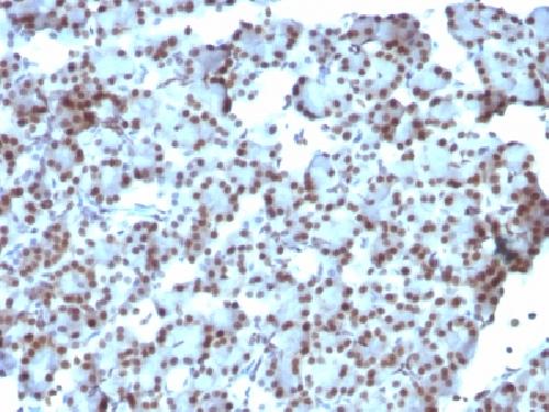 SUMO1 antibody