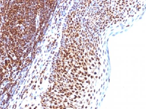 SUMO1 antibody