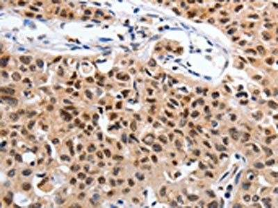 SUMO1 Antibody